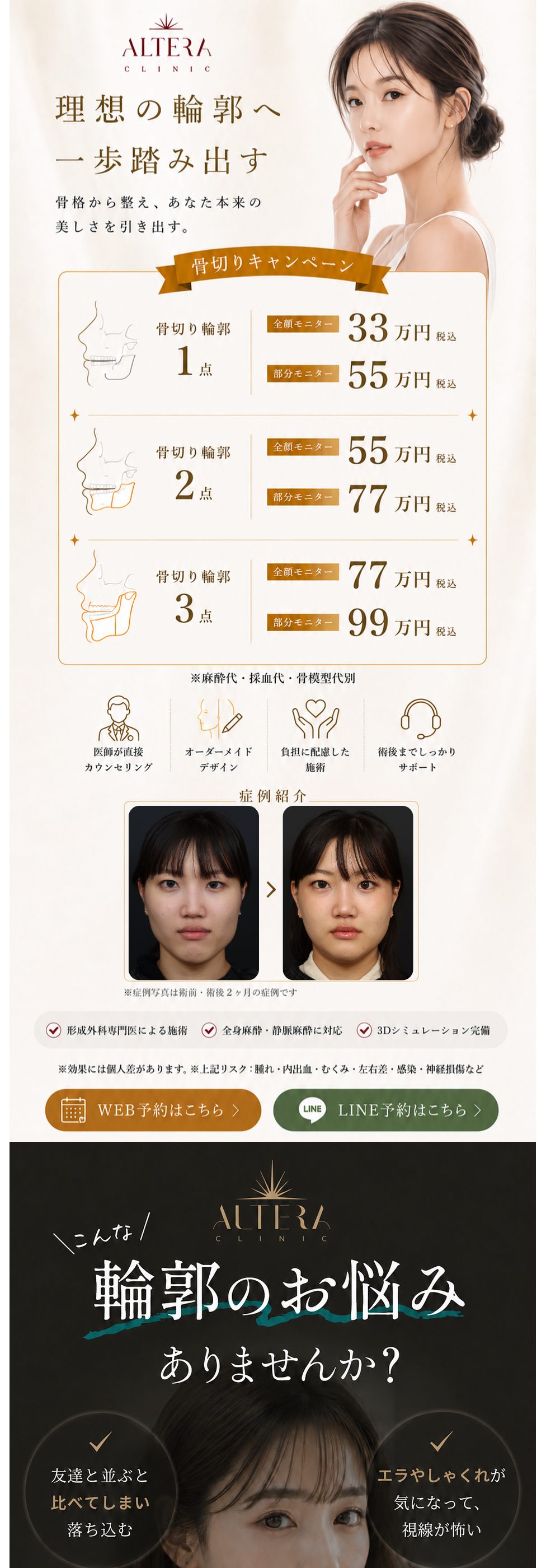 福岡・天神の骨切り・輪郭形成｜骨切りキャンペーン 輪郭1点 全顔モニター33万円・部分モニター55万円／2点 55万円・77万円／3点 77万円・99万円（税込・麻酔代・採血代・骨模型代別） Altera Clinic