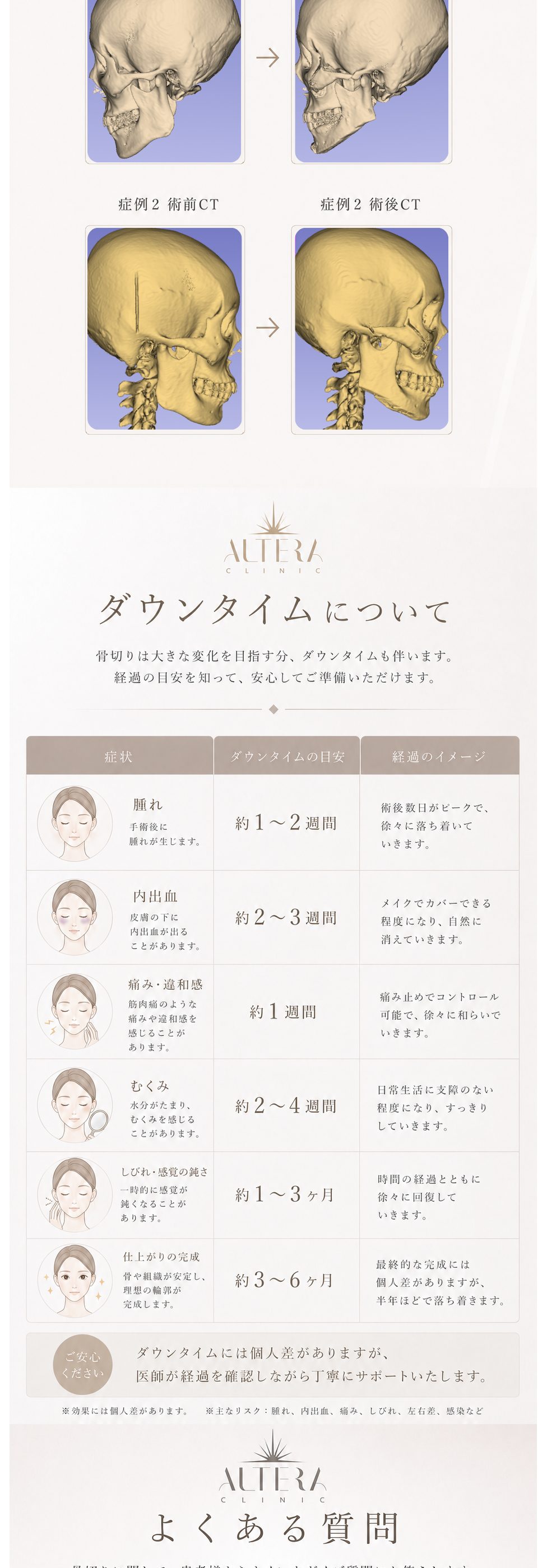 Altera Clinicが選ばれる理由5つ｜形成外科医による執刀・CTを用いたシミュレーション・自然なデザイン・術後フォロー・麻酔管理｜精密CTによる術前シミュレーション
