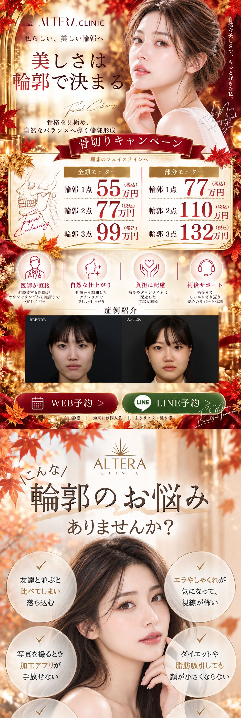 福岡・天神の骨切り・輪郭形成｜美しさは輪郭で決まる｜骨切りキャンペーン 全顔モニター 輪郭1点55万円・2点77万円・3点99万円／部分モニター 輪郭1点77万円・2点110万円・3点132万円（税込）｜医師が直接・自然な仕上がり・負担に配慮・術後サポート｜症例紹介（術前・術後）・WEB予約・LINE予約｜こんな輪郭のお悩みありませんか