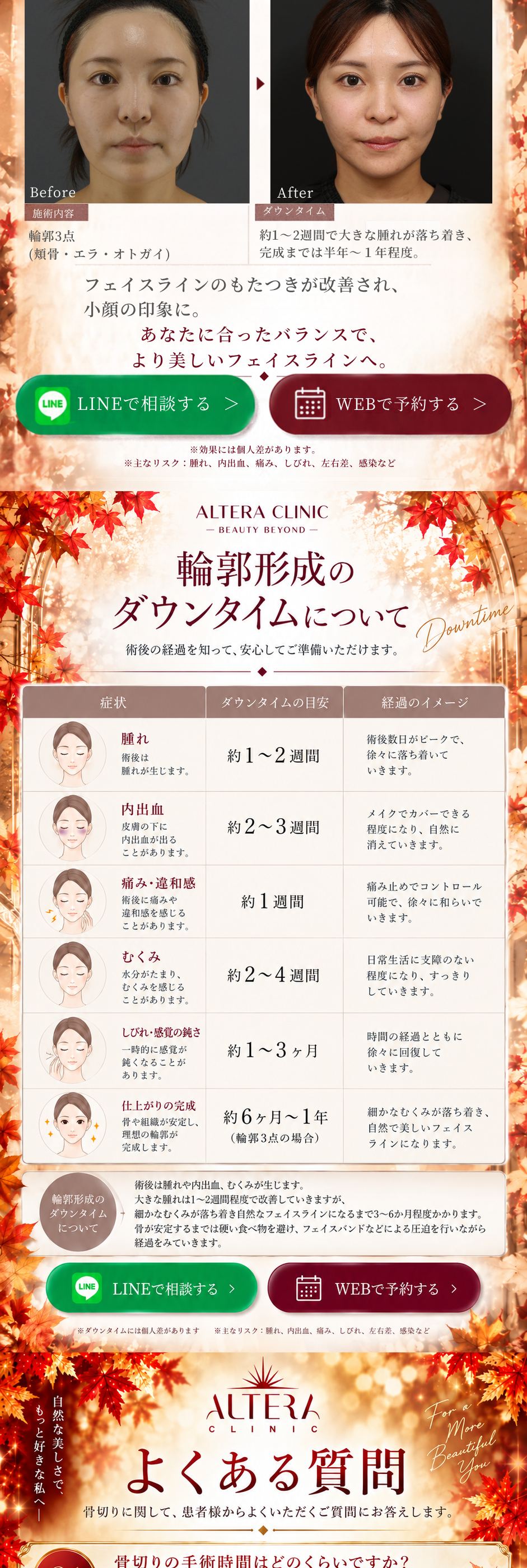 症例紹介 Case02｜施術内容 輪郭3点（頬骨・エラ・オトガイ）・ダウンタイム約1〜2週間で大きな腫れが落ち着き完成までは半年〜1年程度｜LINEで相談する・WEBで予約する｜輪郭形成のダウンタイムについて（腫れ・内出血・痛み違和感・むくみの目安）