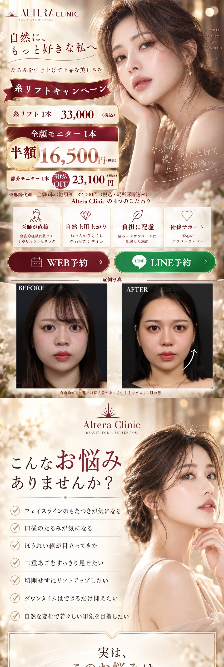 福岡・天神の糸リフト｜糸リフトキャンペーン 糸リフト1本 通常33,000円→全顔モニター16,500円（半額）・部分モニター23,100円（30%OFF）税込・麻酔代別・全顔6本の総額例132,000円（税込・局所麻酔込み）｜Altera Clinicの4つのこだわり（医師が直接・自然な仕上がり・負担に配慮・術後サポート）と症例写真