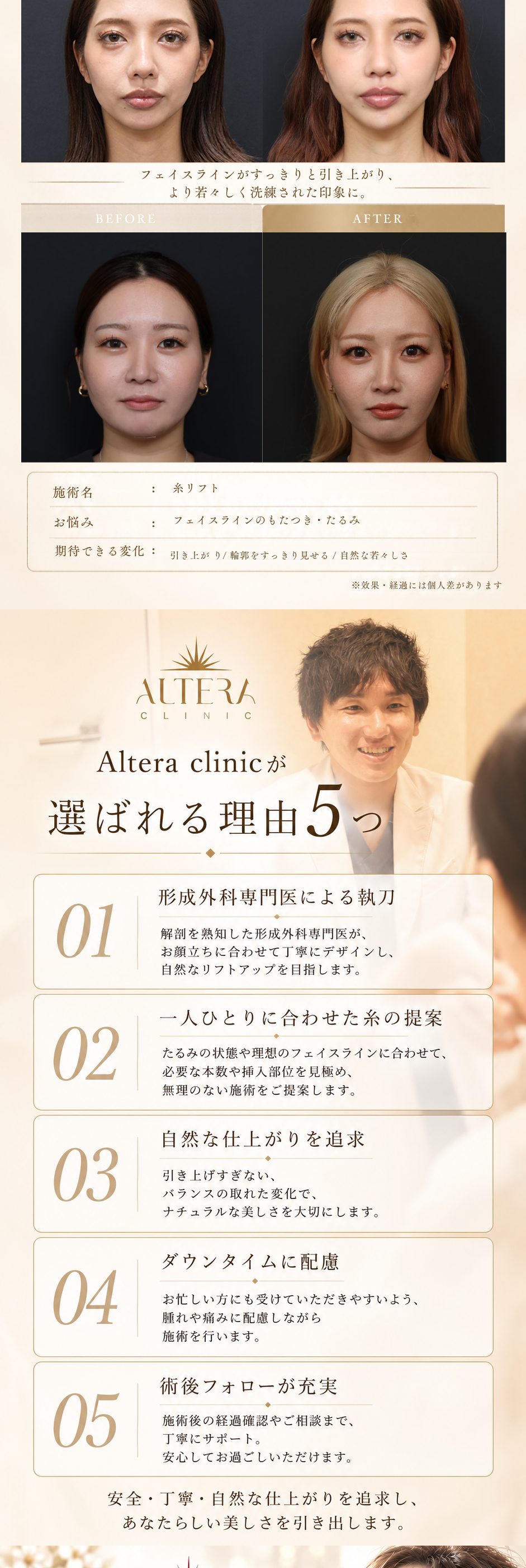 糸リフト症例（術前・術後の写真2例）｜Altera Clinicが選ばれる理由5つ：形成外科専門医による執刀・一人ひとりに合わせた糸の提案・自然な仕上がりを追求