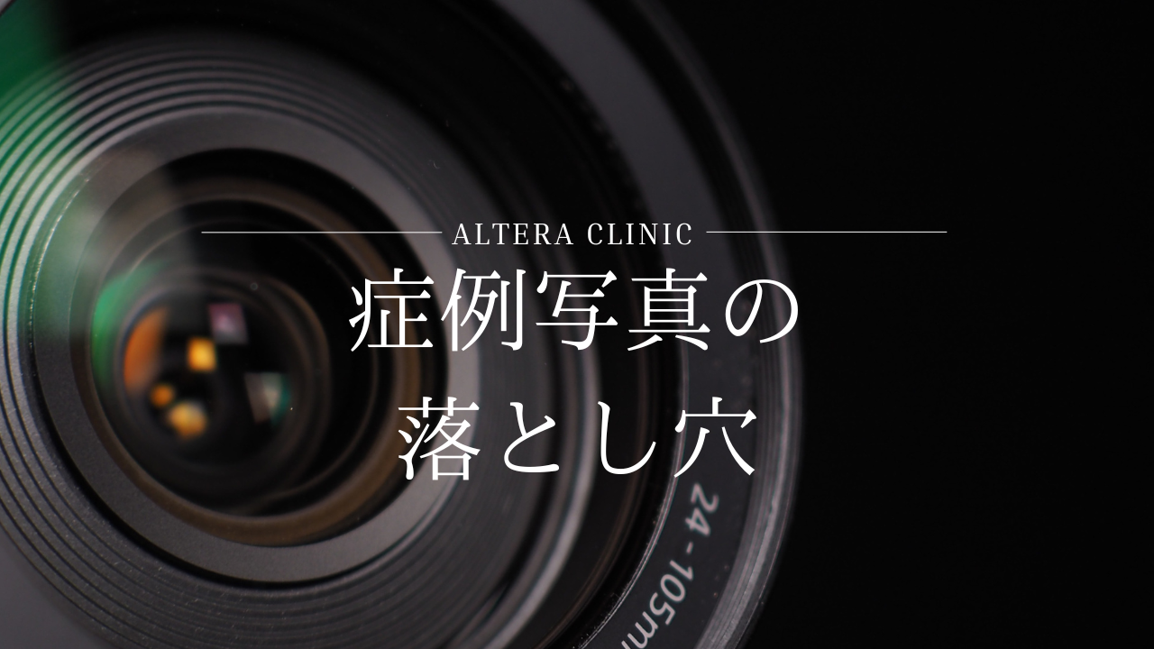 美容外科の「症例写真」の落とし穴