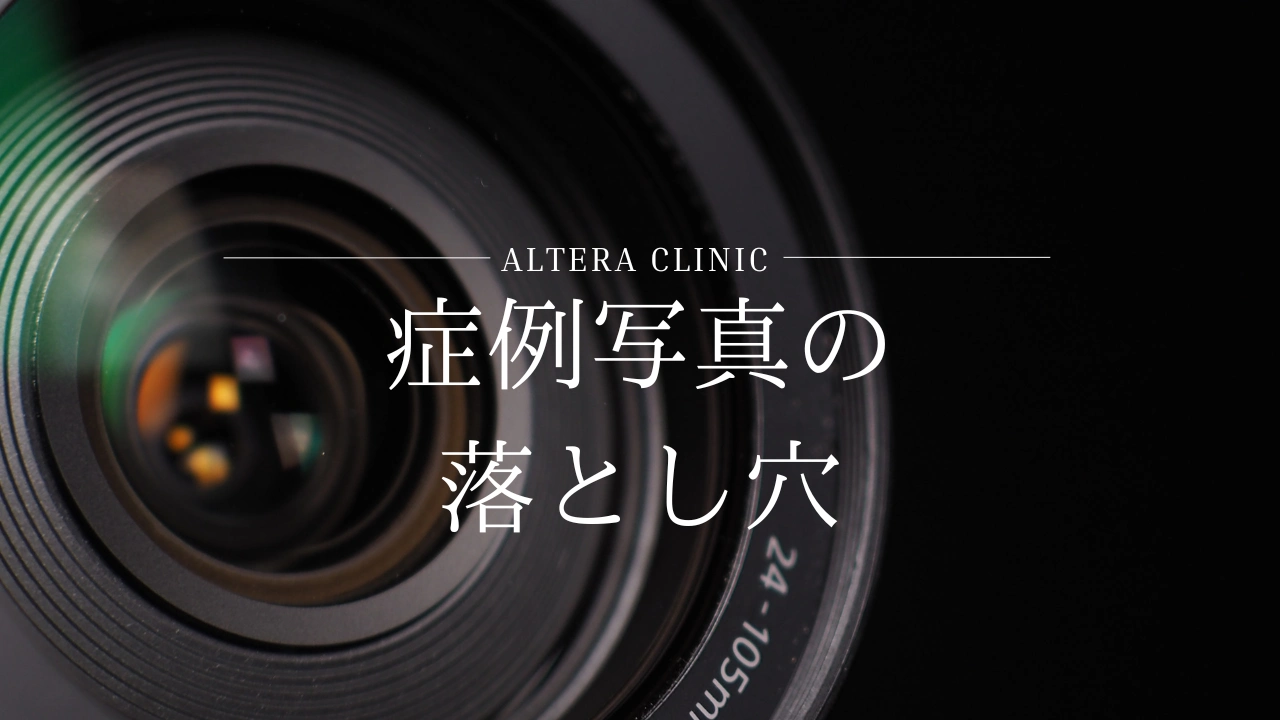 美容整形のビフォーアフター（症例写真）の正しい見方や撮影のトリック、騙されないための注意点を解説したコラムのアイキャッチ画像