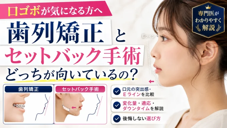 口ゴボが気になる方へ、歯列矯正とセットバック手術の違いや適応を比較解説する美容外科コラムのアイキャッチ画像
