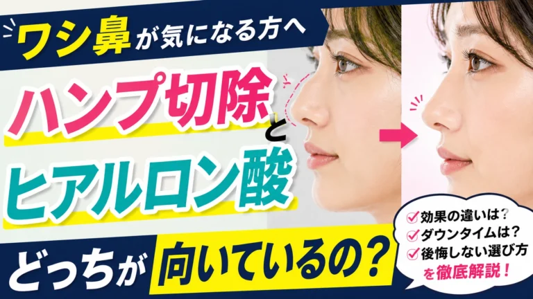ワシ鼻が気になる方へ、ハンプ切除とヒアルロン酸注入の違いや適応を比較解説する美容外科コラムのアイキャッチ画像